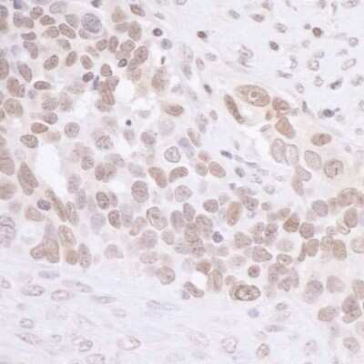 Immunohistochemistry: MIS12 Antibody [NB100-2359]