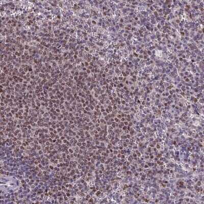 Immunohistochemistry-Paraffin: MIS12 Antibody [NBP1-92118]