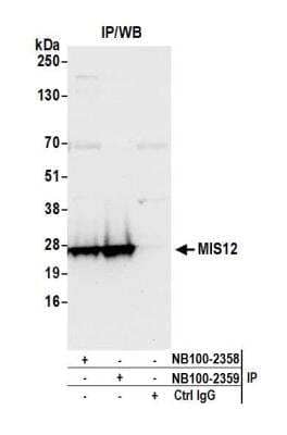 Immunoprecipitation: MIS12 Antibody [NB100-2358]