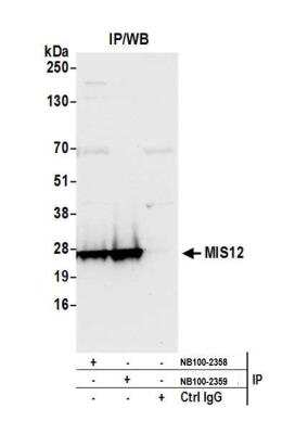 Immunoprecipitation: MIS12 Antibody [NB100-2359]