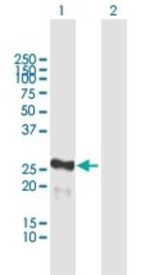 Western Blot: MIS12 Antibody [H00079003-B02P]