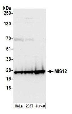 Western Blot: MIS12 Antibody [NB100-2359]