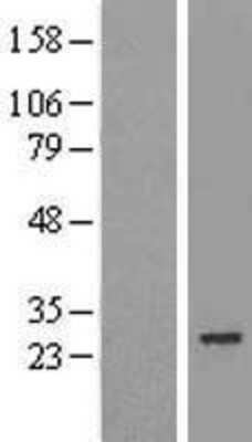 Western Blot: MIS12 Overexpression Lysate [NBL1-13115]