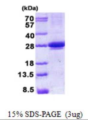 SDS-PAGE: Recombinant Human MIS12 His Protein [NBP2-23237]