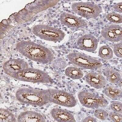 Immunohistochemistry-Paraffin: MISP1 Antibody [NBP2-14390]