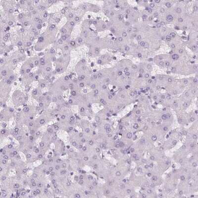 Immunohistochemistry-Paraffin: MISP1 Antibody [NBP2-14390]