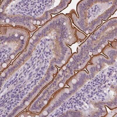Immunohistochemistry-Paraffin: MISP1 Antibody [NBP2-14390]