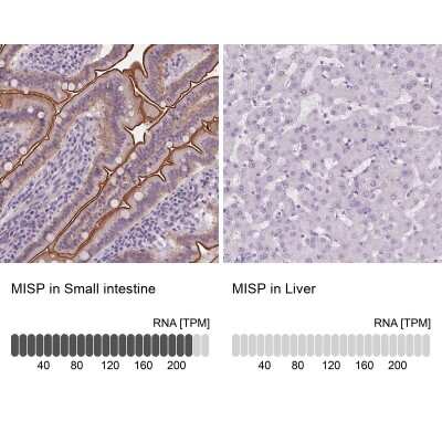 Immunohistochemistry-Paraffin: MISP1 Antibody [NBP2-14390]