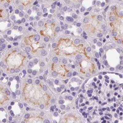 Immunohistochemistry-Paraffin: MISP1 Antibody [NBP2-14390]