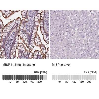 Immunohistochemistry-Paraffin: MISP1 Antibody [NBP2-14390]