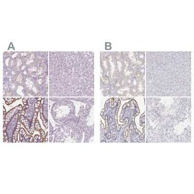 Immunohistochemistry-Paraffin: MISP1 Antibody [NBP2-14390]