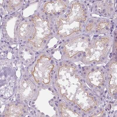Immunohistochemistry-Paraffin: MISP1 Antibody [NBP2-14390]