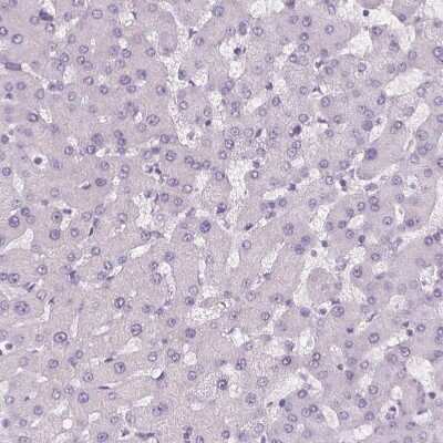 Immunohistochemistry-Paraffin: MISP1 Antibody [NBP2-14390]