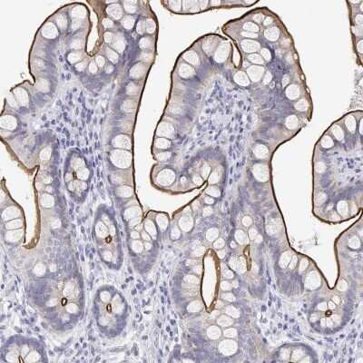 Immunohistochemistry-Paraffin: MISP1 Antibody [NBP2-38955]