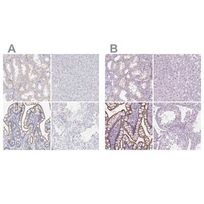 Immunohistochemistry-Paraffin: MISP1 Antibody [NBP2-38955]