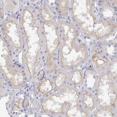 Immunohistochemistry-Paraffin: MISP1 Antibody [NBP2-38955]