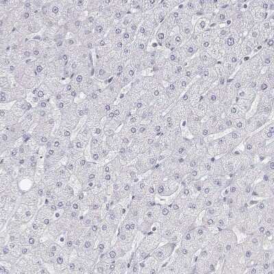 Immunohistochemistry-Paraffin: MISP1 Antibody [NBP2-38955]