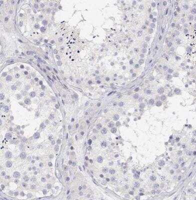 Immunohistochemistry-Paraffin: MISP1 Antibody [NBP2-38955]