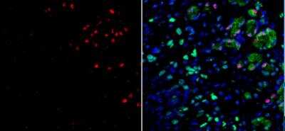 Immunohistochemistry: MIST1 Antibody (6E8/A12/C11P1) [NBP2-22478]