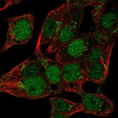 Immunocytochemistry/ Immunofluorescence: MIST1 Antibody [NBP2-30979]