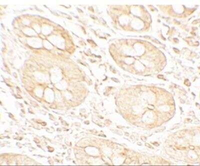 Immunohistochemistry: MIST1 Antibody - BSA Free [NBP2-82007]