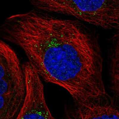 Immunocytochemistry/ Immunofluorescence: MITD1 Antibody [NBP2-32721]