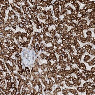 Immunohistochemistry-Paraffin: MITD1 Antibody [NBP1-82828]