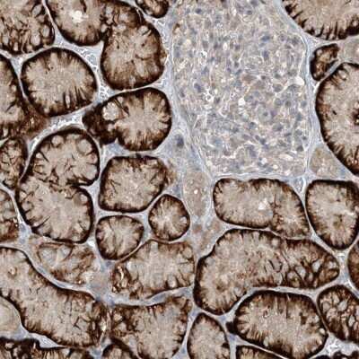 Immunohistochemistry-Paraffin: MITD1 Antibody [NBP2-32721]