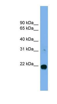 Western Blot: MITD1 Antibody [NBP1-57006]