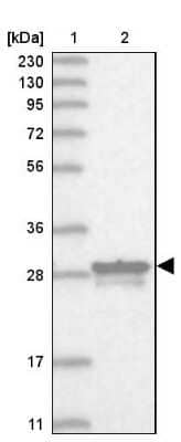 Western Blot: MITD1 Antibody [NBP1-82828]