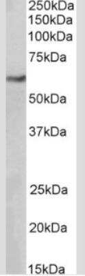 Western Blot: MITF Antibody (21D1418)Azide Free [NBP2-33229]