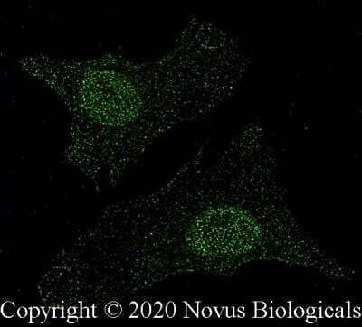 Immunocytochemistry/ Immunofluorescence: MITF Antibody (21D1418) - BSA Free [NB100-56561]