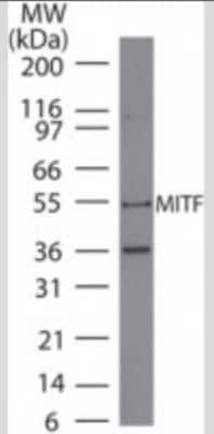 Western Blot: MITF Antibody (21D1418)BSA Free [NB100-56561]