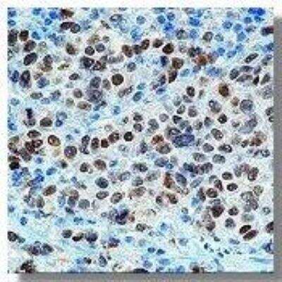 Immunohistochemistry-Paraffin: MITF Antibody (C5/D5 Cocktail) [NBP2-66627]