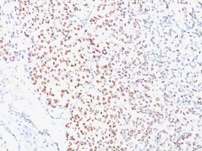 Immunohistochemistry-Paraffin: MITF Antibody (C5/D5) - IHC-Prediluted [NBP2-48263]