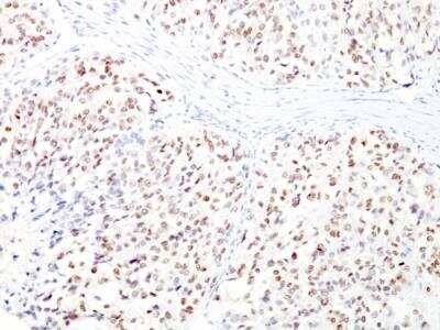 Immunohistochemistry-Paraffin: MITF Antibody (D5 + MITF/915) - IHC-Prediluted [NBP2-48281]