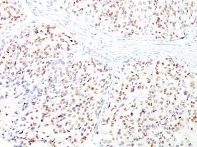 Immunohistochemistry-Paraffin: MITF Antibody (D5 + MITF/915) [NBP2-45162]