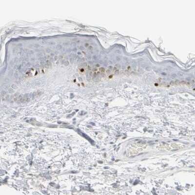 Immunohistochemistry-Paraffin: MITF Antibody [NBP1-88618]