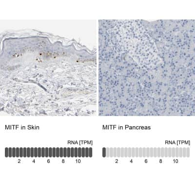 Immunohistochemistry-Paraffin: MITF Antibody [NBP1-88618]