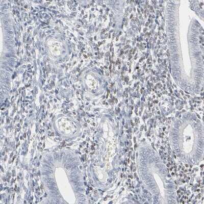 Immunohistochemistry-Paraffin: MITF Antibody [NBP1-88618]