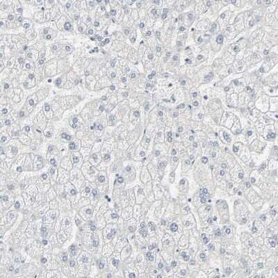 Immunohistochemistry-Paraffin: MITF Antibody [NBP1-88618]