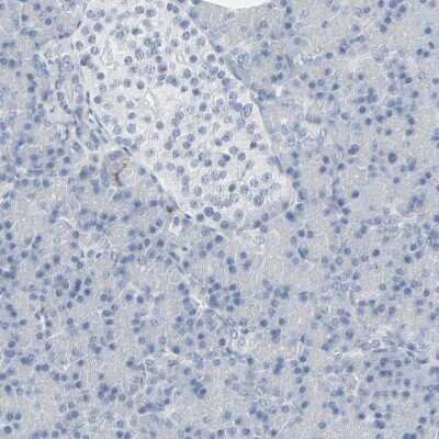 Immunohistochemistry-Paraffin: MITF Antibody [NBP1-88618]
