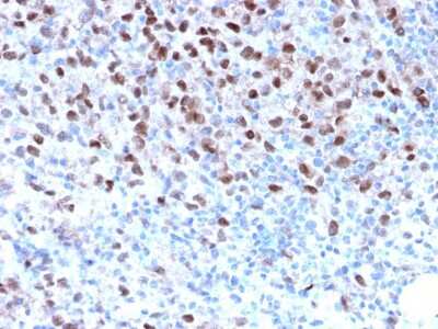 Immunohistochemistry-Paraffin: MITF Antibody (MITF/2987R) - Azide and BSA Free [NBP3-08590]