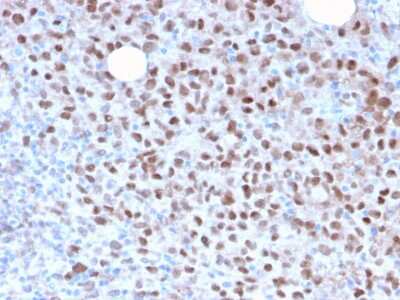 Immunohistochemistry-Paraffin: MITF Antibody (MITF/2987R) - Azide and BSA Free [NBP3-08590]