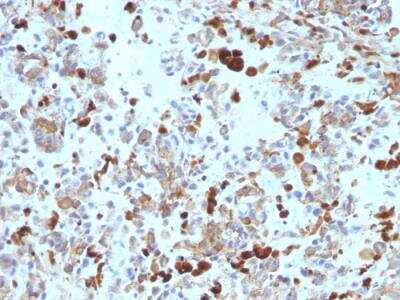 Immunohistochemistry-Paraffin: MITF Antibody (MITF/915) - IHC-Prediluted [NBP2-48280]