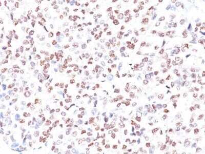 Immunohistochemistry-Paraffin: MITF Antibody (MITF/915) - IHC-Prediluted [NBP2-48280]