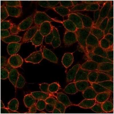 Immunocytochemistry/ Immunofluorescence: MITF Antibody (PCRP-MITF-1D9) [NBP3-13968]