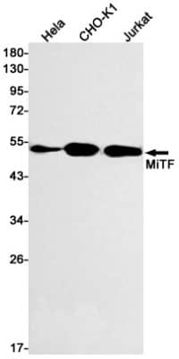 Western Blot: MITF Antibody (S06-4B5) [NBP3-19691]