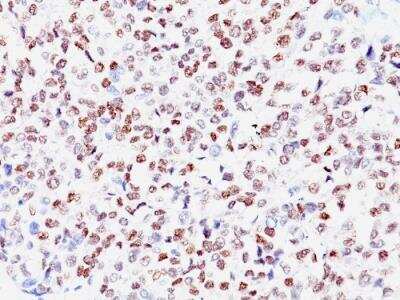 Immunohistochemistry-Paraffin: MITF Antibody (SPM290) - IHC-Prediluted [NBP2-48279]