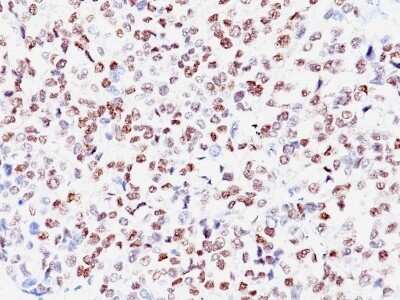 Immunohistochemistry-Paraffin: MITF Antibody (SPM290) [NBP2-45160]